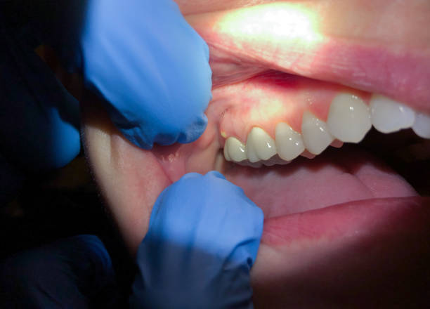 Best Cosmetic Emergency Dentistry in Caruthersville, MO